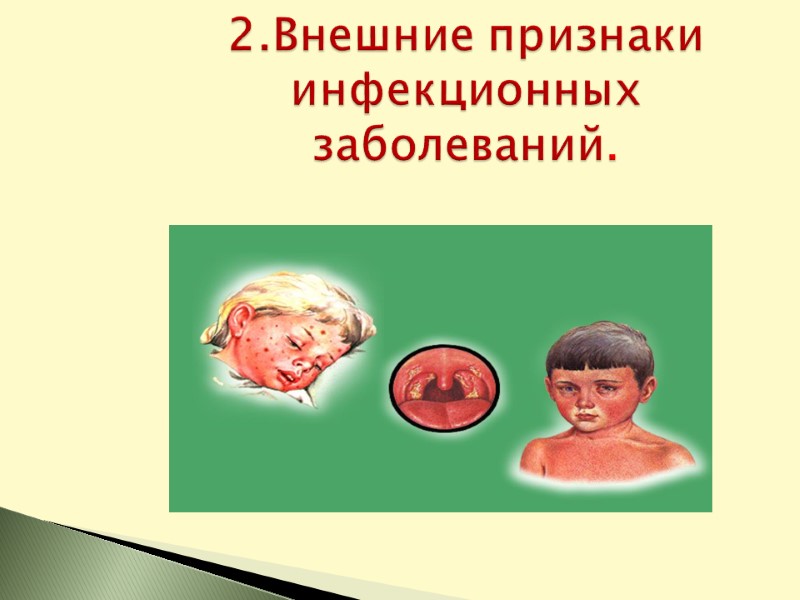 2.Внешние признаки инфекционных заболеваний.